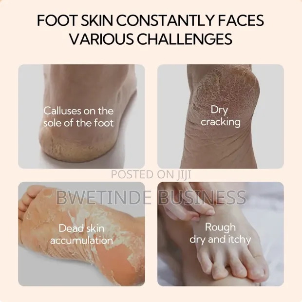 Lanbena Foot Repair Cream - 1