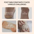 Lanbena Foot Repair Cream - 1