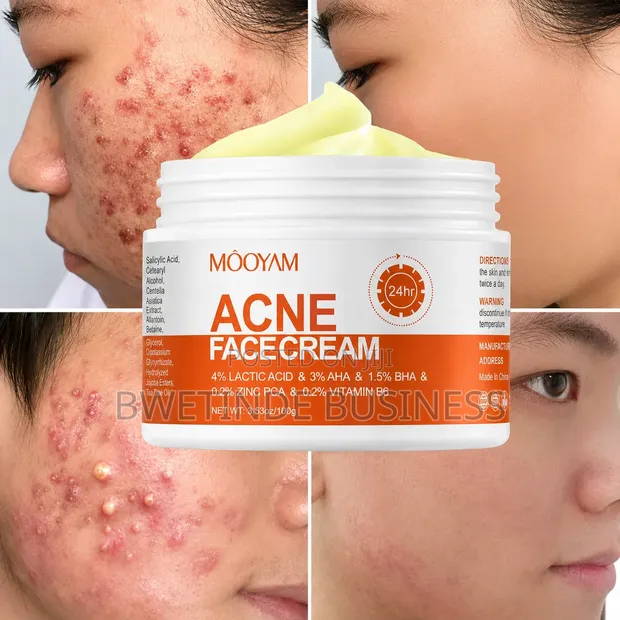 Mooyam Herbal Acne Removal Cream - 1