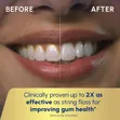 Waterpik Aquarius Water Flosser for Dental Care - 5