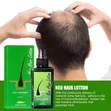 Neo Hair Growth Lotion - 3