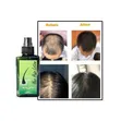 Neo Hair Growth Lotion - 4
