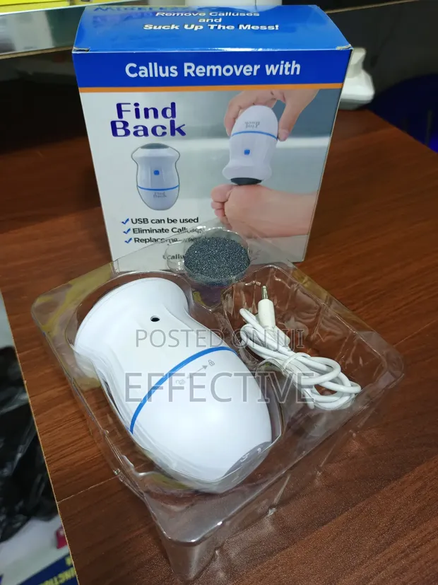 Electric Foot File Callus Remover - 1