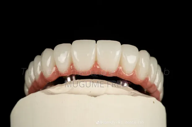 Smile Makeover Service - 1