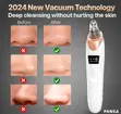 5-in-1 Blackhead Remover Machine - 2