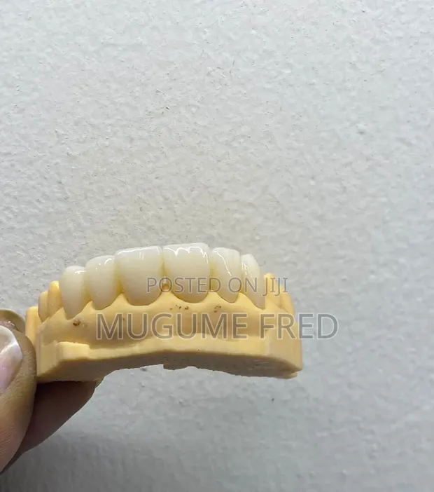 Full Mouth Rehabilitation Service - 1