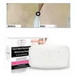 Aichun Beauty Dark Spot Remover Whitening Soap 100g - 2