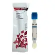 Platelet-Rich Plasma (PRP) Tube - 1