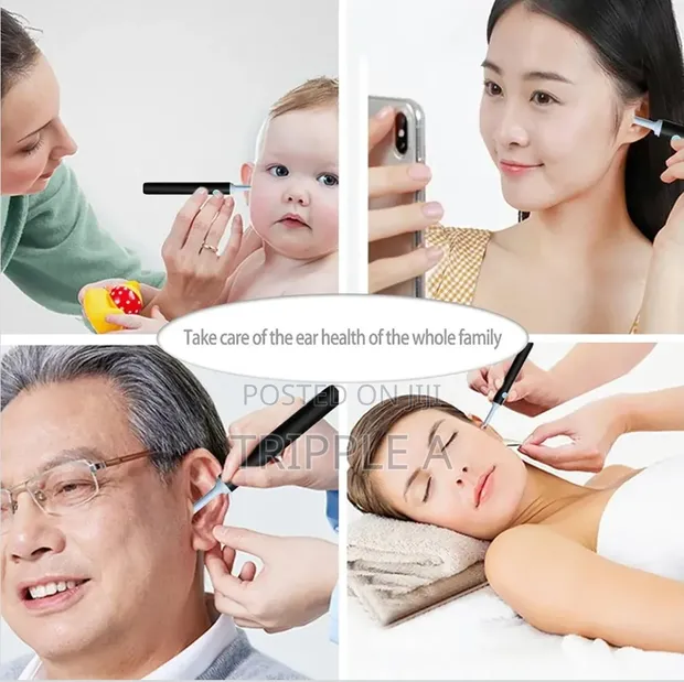 Smart Visual Ear Cleaner Wax Removal Tool - 1