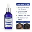 Hair Growth Tonic: 15% Minoxidil + Finasteride Oil for Fast Beard & Hair Regrowth - 2