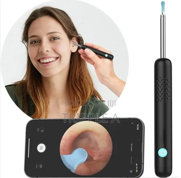Visual Ear Cleaning Tool with FHD Camera - 1
