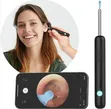 Visual Ear Cleaning Tool with FHD Camera - 1