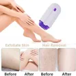 Hubs Painless Hair Remover Epilator - 4