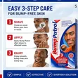 Bump Patrol Face & Head Razor Bump Solution - 4