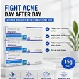 Adaferin Adapalene Gel 0.1% - 15g - 4