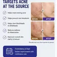 Epiduo Gel - Adapalene 0.1% + Benzoyl Peroxide 2.5% - 3