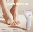 Winning Star Electric Foot Callus Remover ST-5851 - 1