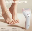 Winning Star Electric Foot Callus Remover (ST-5851) - 1