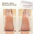 Winning Star Electric Foot Callus Remover (ST-5851) - 2