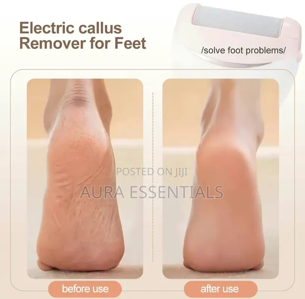 Winning Star Electric Foot Callus Remover ST-5851 - 1