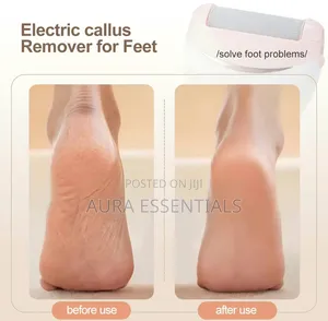 Winning Star Electric Foot Callus Remover ST-5851