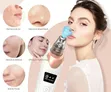 Electric Blackhead Remover Vacuum - 1