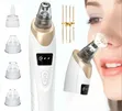 Electric Blackhead Remover Vacuum - 2