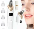Electric Blackhead Remover Vacuum - 2