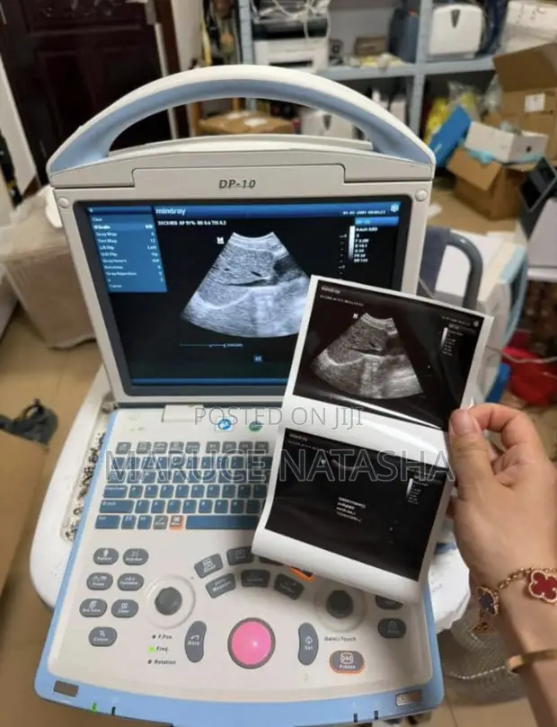 Refurbished Mindray Ultrasound Scan Machine - 1