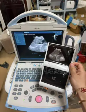 Refurbished Mindray Ultrasound Scan Machine