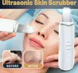 Ultrasonic Facial Skin Scrubber & Moisturizing Spray Tool - 2