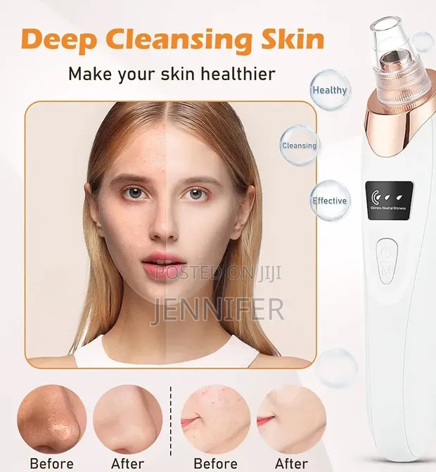 Electric Blackhead Remover Vacuum - 1