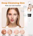 Electric Blackhead Remover Vacuum - 1