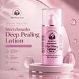 Stretchmarks Deep Peeling Lotion - 500ml - 1