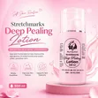 Stretchmarks Deep Peeling Lotion - 500ml - 4