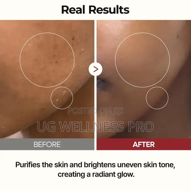 Dr. Melaxin Peel Shot Glow Rice Toner - Korean Glass Skin - 1