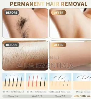 IPL Hair Removal Device - 500,000 Flashes