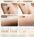 IPL Hair Removal Device - 500,000 Flashes - 1