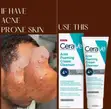 CeraVe Acne Foaming Cream Cleanser with 4% Benzoyl Peroxide - 2