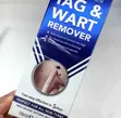 Dr. Davey Wart Tag Remover Solution - 1