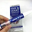 Dr. Davey Wart Tag Remover Solution - 3