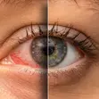 Lumin Instant Eye Whitening Drops - 2