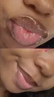 3 Days Pink Lips Treatment Moisturizing Cream - 2