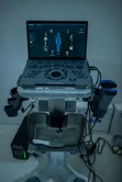 CHISON SonoAir Portable Laptop Ultrasound System - 4