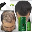 BUNEE 120ml Hair Growth Treatment Spray - 3