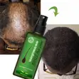 BUNEE 120ml Hair Growth Treatment Spray - 4