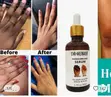 Dr. Davey Dark Knuckles Whitening Serum - 2