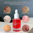 Anua Niacinamide 10% + TXA 4% Dark Spot Serum 30ml - 2
