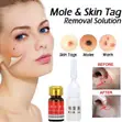Dr. Luei Speckle Killer & Wart/Skin Tag Remover Kit - 2