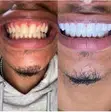 Efero Teeth Whitening Liquid - 5
